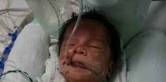anak meninggal komplikasi jantung