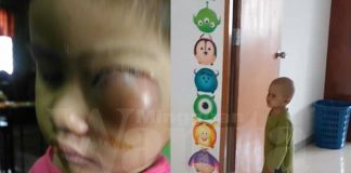 kanser mata