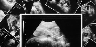 murid darjah 6 mengandung