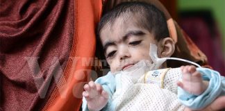 tubuh macam bayi