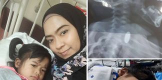 Debaran 2 Hari Menanti PEMBEDAHAN Bila Anak 2 Tahun Tertelan Syiling, Doa Dan Zikir Inilah Yang Ibunya Baca Agar Tak Cemas