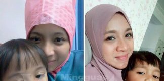 Kalau JATUH TERDUDUK Cepat Ke Hospital, Jangan Mak-mak Cuba Tanggung Sakit Dan Rasa Diri Tu Kuat
