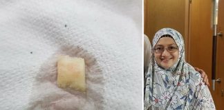 Nampak Hidung Anak Bawah 4 Tahun Berair Busuk Dan Berhingus, Suka Pula Sumbat ‘Benda Kecil’ Kat Area Tu, Cepatlah Bertindak