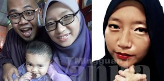 Dihina, Ditolak Dari Berkahwin Kerana Vitiligo @ Sopak, Akhirnya Jejaka PALAPES Ini Jadi Penyelamat