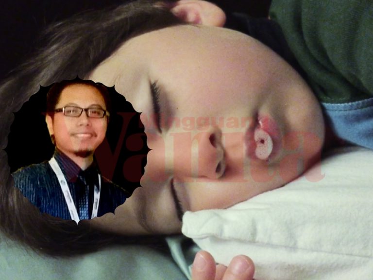 anak kena sawan