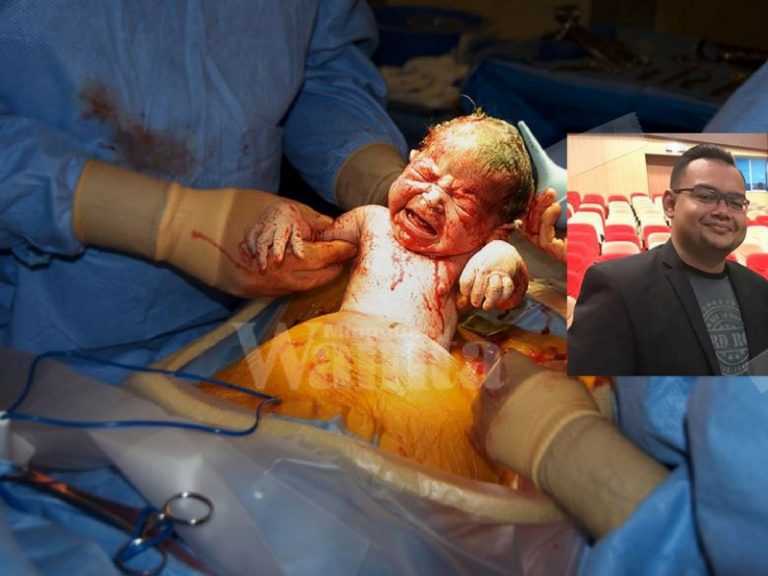 caesarean