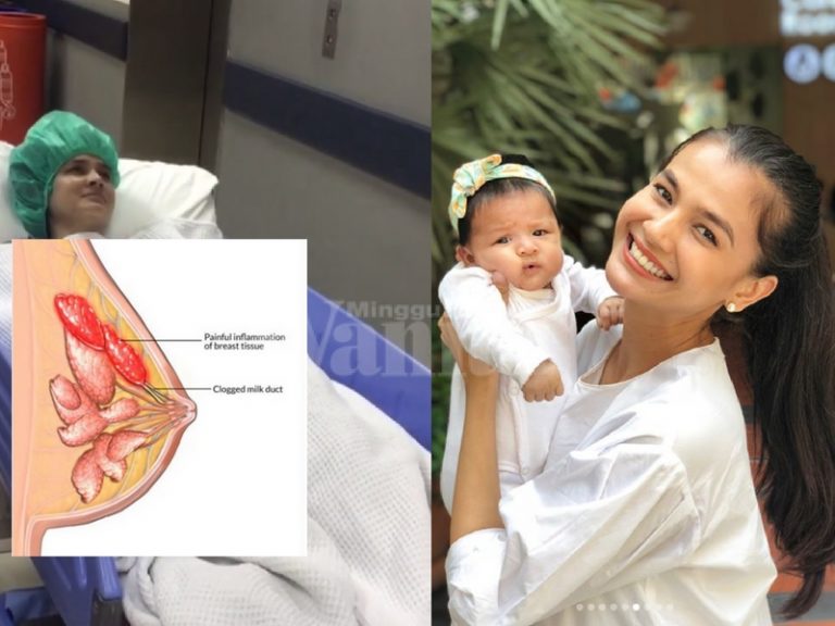 3 Minggu Derita Bengkak Susu Sehingga Jadi Nanah & Terpaksa Dibedah, Sakitnya Allah Je Yang Tahu