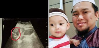 Ustaz Ini Kongsi Pesakitnya Ada 2 Line Positif Mengandung, Buat Pemeriksaan Air Kencing Negatif, Bila Di Ruqyah Menjerit Kesakitan