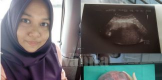 cyst