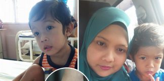 “Benarkah Bayi Ada Tanda Lahir Mudah Dapat Sawan?” Ibu Tanya Doktor Dan Inilah Jawapannya..