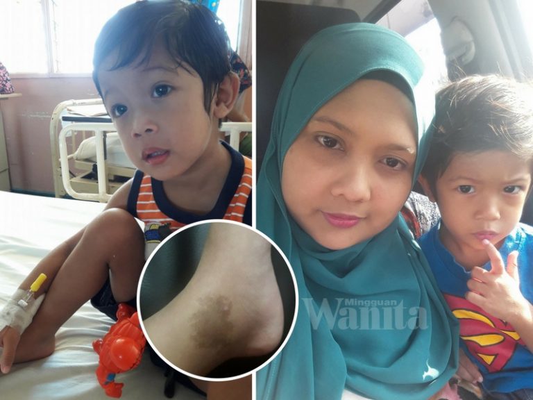 “Benarkah Bayi Ada Tanda Lahir Mudah Dapat Sawan?” Ibu Tanya Doktor Dan Inilah Jawapannya..