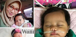 Alhamdulillah Pembedahan Sumbing Baby Xandra Dah Selesai, Ini Doa Lan Solo Untuk Anaknya