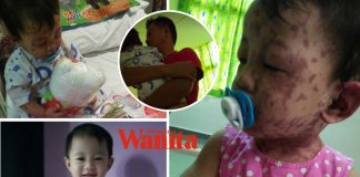 ‘Aisyah Kuat Sikit Ya, InsyaAllah Cantik Macam Dulu’ Tolong Doakan Bayi 17 Bulan Ini Dapat Lawan Trauma