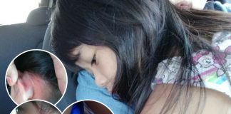 ‘Allahuakbar! Telinga Anak Aku..’ Rasa Tak Sedap Hati Ibu Ini Akhirnya Terbongkar Bila Anaknya 'Buka Mulut’