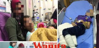 Bantulah! Kesemua Jari Anak Istimewa Ini Terpaksa Dipotong, Selepas Kaki Kanan Masuk Dalam Rim Motor