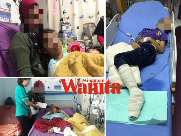 Bantulah! Kesemua Jari Anak Istimewa Ini Terpaksa Dipotong, Selepas Kaki Kanan Masuk Dalam Rim Motor