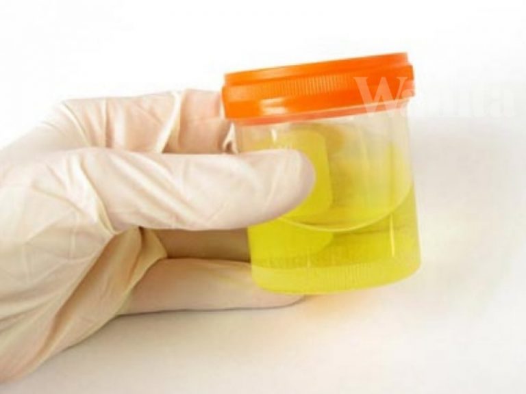 urine Theraphy