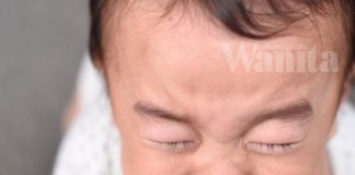 Doktor Terang Kenapa Anak Demam Cirit Birit, Boleh Kena ‘Temporary Lactose Intolerance'