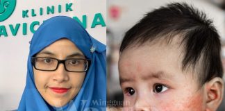 Bila Confirm Ada Penyakit 'Kulit Gatal', Cegahlah Pencetus Ekzema Ikut Saranan Doktor