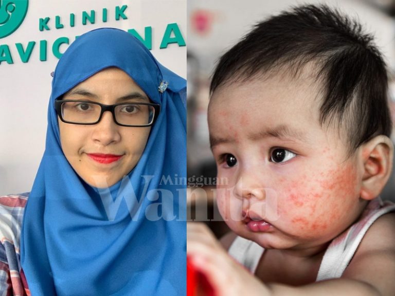 Bila Confirm Ada Penyakit 'Kulit Gatal', Cegahlah Pencetus Ekzema Ikut Saranan Doktor