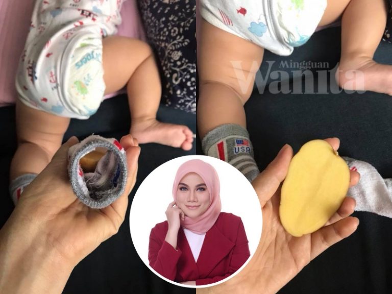 Mak-mak Petua Letak Kentang Dalam Stoking, Mujarab Redakan Batuk, Selesema Anak