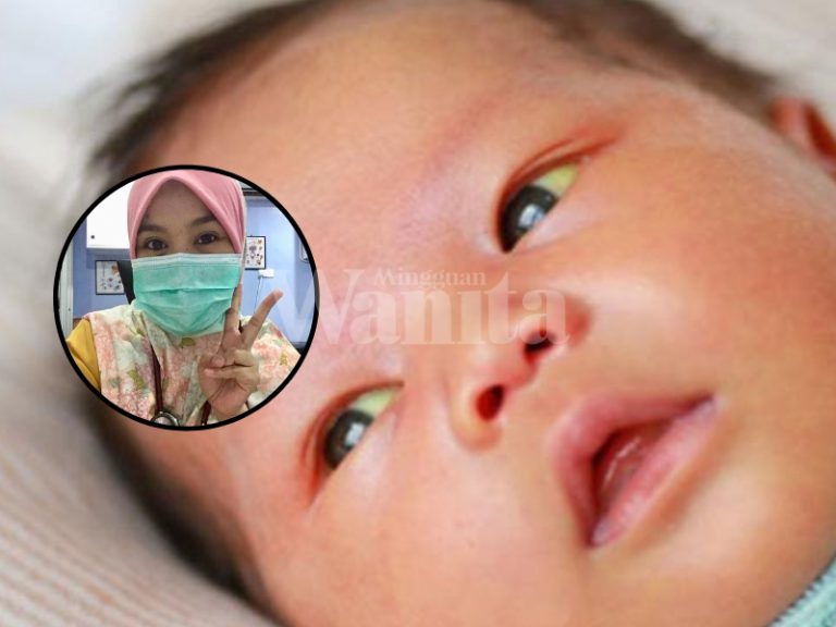 bayi kuning