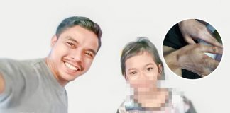 TERKINI : Sebab Dikurung Lama Dalam Bilik Air, Jari Kelingking Tak Boleh Lurus