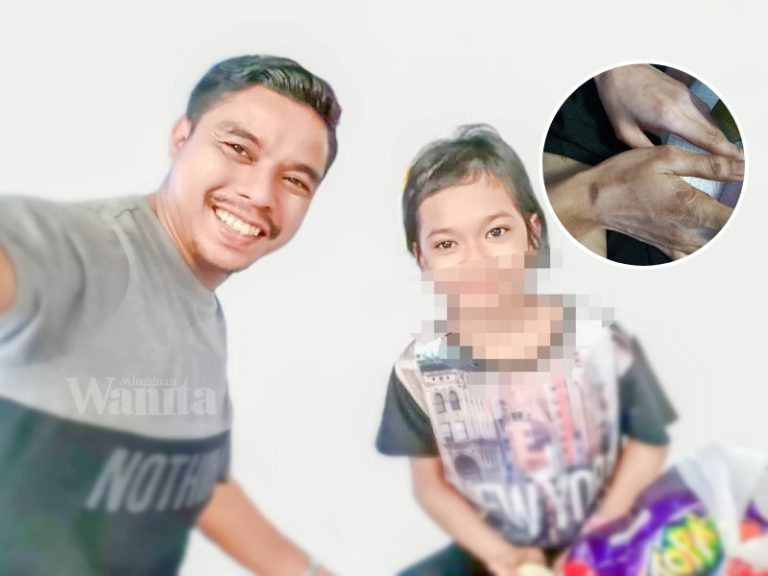TERKINI : Sebab Dikurung Lama Dalam Bilik Air, Jari Kelingking Tak Boleh Lurus