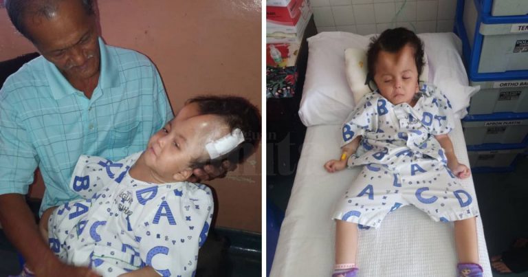 Doktor Jangka Hayat Anak Kecil Ini Mungkin Tak Panjang, Tapi Syukur Hingga Kini Batrisyia Masih Bernyawa