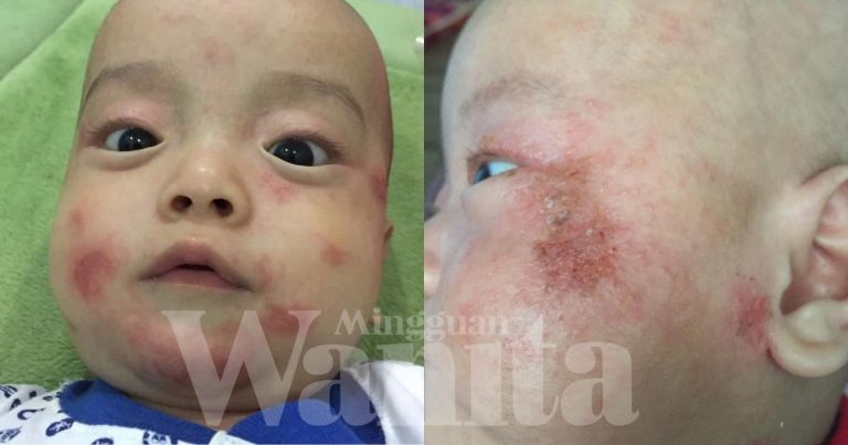 Kulit Kepala Izz Ayden Berair & Melekat Di Bantal – Nurul Asmak