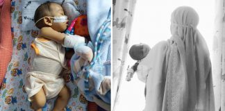 Ayah Jadi Penderma Hati Anak, Kos Pembedahan Saja RM120,000, Sumbanglah Seikhlasnya