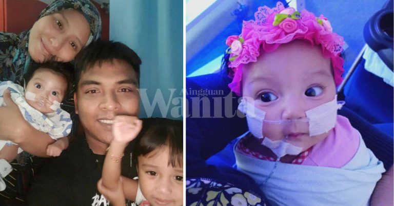 Anak Ali Puteh Bergantung Bantuan Pernafasan, Alami Kompilkasi Paru-paru Selepas Pembedahan