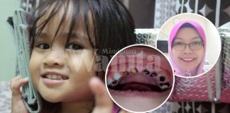 Tidur Sambil Hisap Susu, Kongsi Sudu, Inilah Punca Karies Gigi Anak