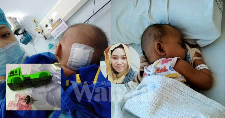 Insiden Bayi 9 Bulan Tertusuk Tayar Kereta, Hati-Hati Pilih Mainan Anak!