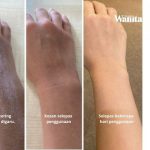 Patutlah Ramai Cari, Skincare Koolit Berkesan Rawat 5 Masalah Kulit