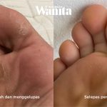 Patutlah Ramai Cari, Skincare Koolit Berkesan Rawat 5 Masalah Kulit