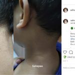 Patutlah Ramai Cari, Skincare Koolit Berkesan Rawat 5 Masalah Kulit