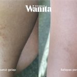 Patutlah Ramai Cari, Skincare Koolit Berkesan Rawat 5 Masalah Kulit