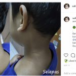 Patutlah Ramai Cari, Skincare Koolit Berkesan Rawat 5 Masalah Kulit