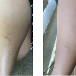 Patutlah Ramai Cari, Skincare Koolit Berkesan Rawat 5 Masalah Kulit