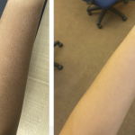 Patutlah Ramai Cari, Skincare Koolit Berkesan Rawat 5 Masalah Kulit