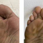 Patutlah Ramai Cari, Skincare Koolit Berkesan Rawat 5 Masalah Kulit