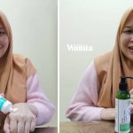 Patutlah Ramai Cari, Skincare Koolit Berkesan Rawat 5 Masalah Kulit