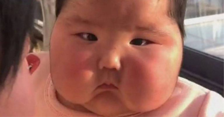 Gara-Gara Disapu Krim Pelembab, Pipi Bayi Kembung, Ditumbuhi Rambut