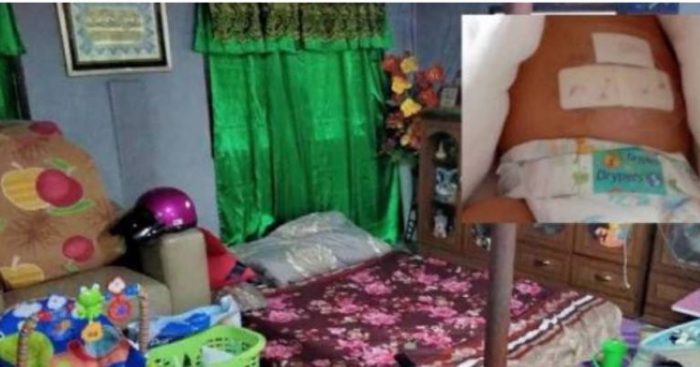 Ibu Bancuh Susu, Bayi 50 Hari Cedera Digigit Kera Ketika Tidur