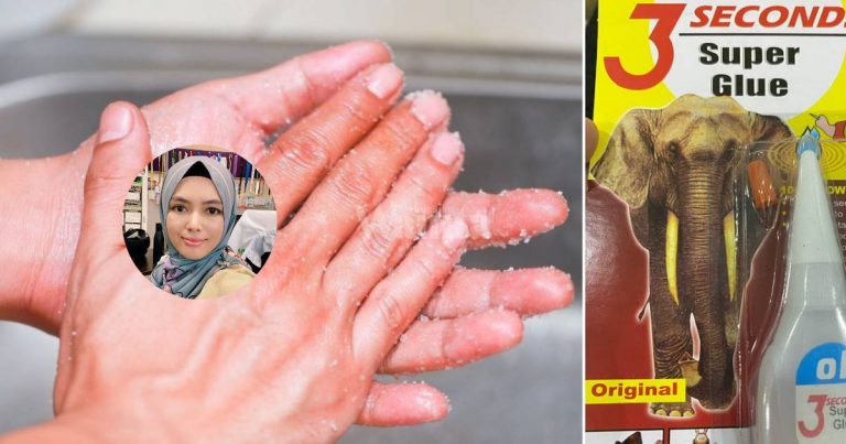 Rupanya Cara Berkesan Tanggalkan ‘Superglue’ Melekat Pada Kulit Guna GARAM!