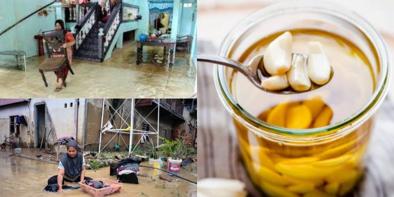 Lumur Minyak Pakai Stokin, PETUA Elak Kulat Air & Kaki Kecut Terendam Banjir!