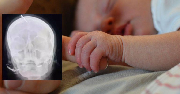 “Takut DiTinggalkan Suami.” Isteri Sanggup Benam Paku Di Kepala Untuk Dapatkan Bayi Lelaki