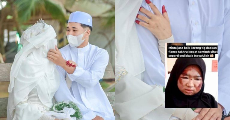 Cedera Di Muka 5 Hari Sebelum Ijab Kabul.” Bakal Suami Tidak Terfikir Tangguh Majlis