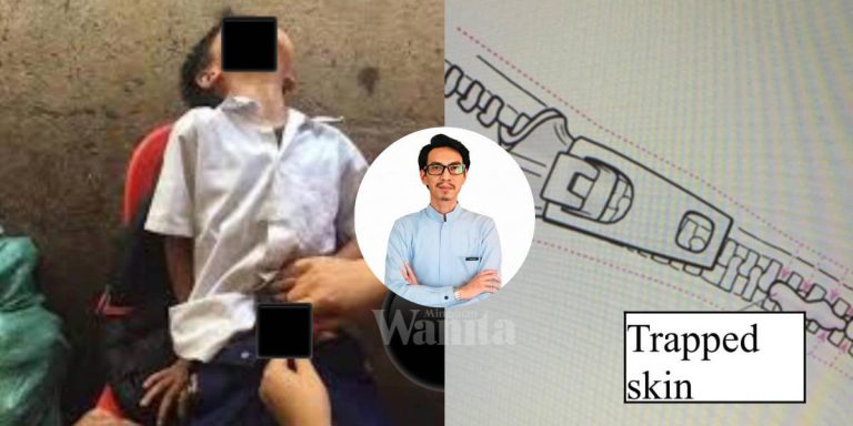Mak Ayah, Cikgu Jangan Panik Jika ‘Bebird’ Anak Tersepit Zip Seluar!